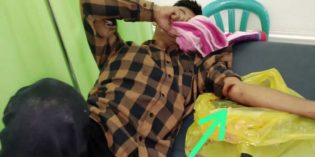 Di Bantarkawung Begal Bacok Korban, Hp dan Dompet di Rampas